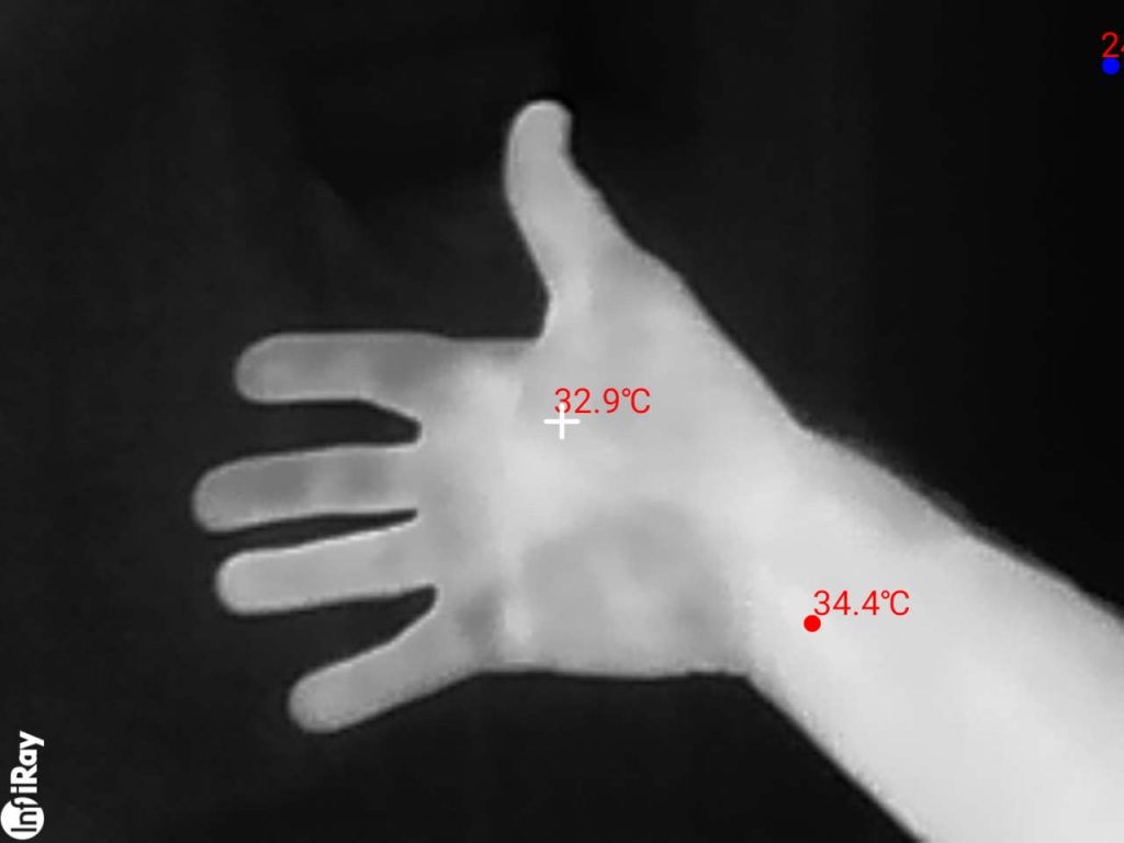 Thermal image of a hand showing measured surface temperatures of 32.9°C and 34.4°C.